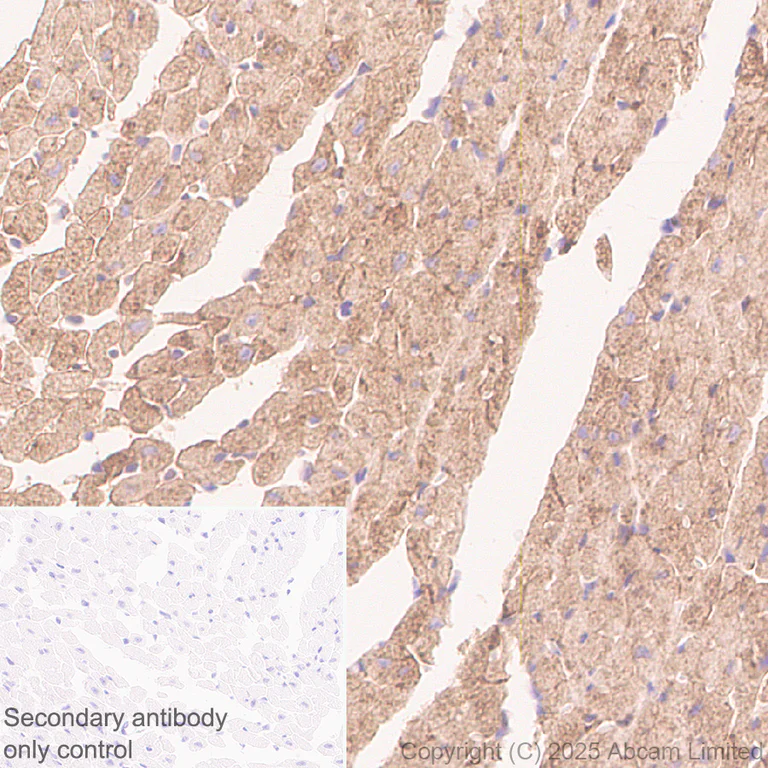 Immunohistochemistry (Formalin/PFA-fixed paraffin-embedded sections) - Anti-Glypican 1/ GPC1 antibody [EPR30349-529] (AB324685)