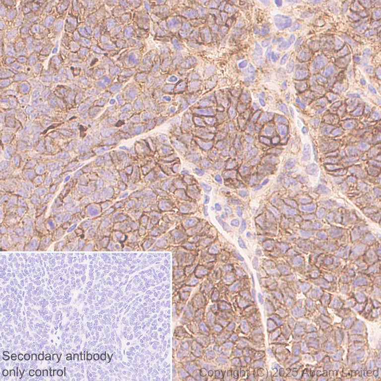 Immunohistochemistry (Formalin/PFA-fixed paraffin-embedded sections) - Anti-Glypican 1/ GPC1 antibody [EPR30349-529] (AB324685)