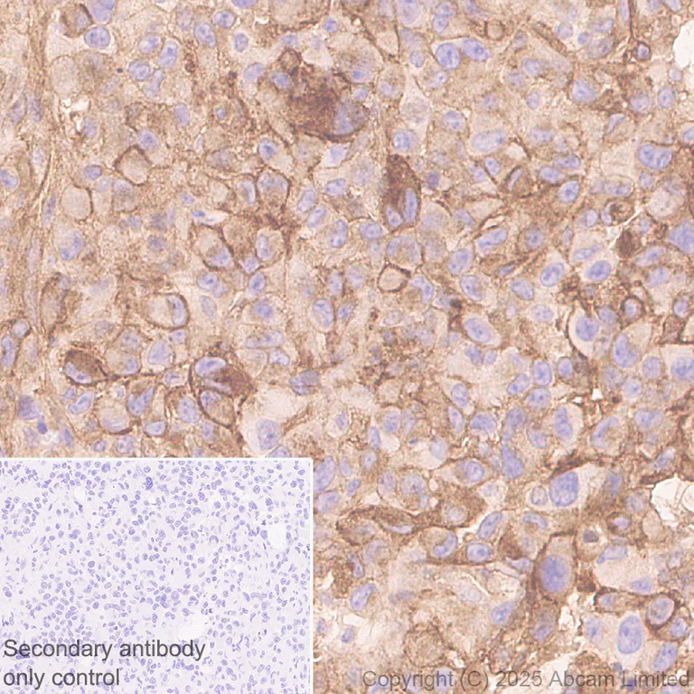 Immunohistochemistry (Formalin/PFA-fixed paraffin-embedded sections) - Anti-Glypican 1/ GPC1 antibody [EPR30349-529] (AB324685)
