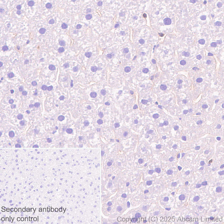Immunohistochemistry (Formalin/PFA-fixed paraffin-embedded sections) - Anti-Glypican 1/ GPC1 antibody [EPR30349-529] (AB324685)