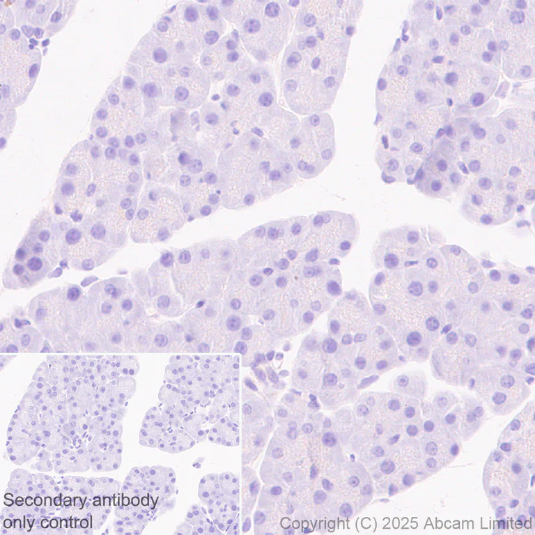 Immunohistochemistry (Formalin/PFA-fixed paraffin-embedded sections) - Anti-Glypican 1/ GPC1 antibody [EPR30349-529] (AB324685)