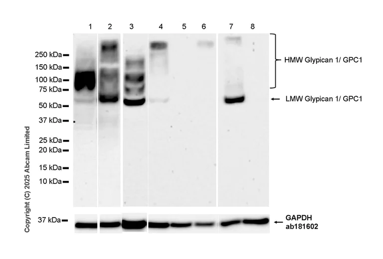 Western blot - Anti-Glypican 1/ GPC1 antibody [EPR30349-529] (AB324685)