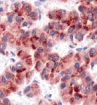 Immunohistochemistry (Formalin/PFA-fixed paraffin-embedded sections) - Anti-Glypican 3 antibody (AB93880)