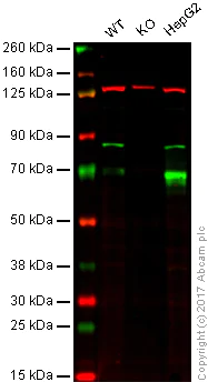 Western blot - Anti-Glypican 3 antibody [EPR10641] - BSA and Azide free (AB221498)