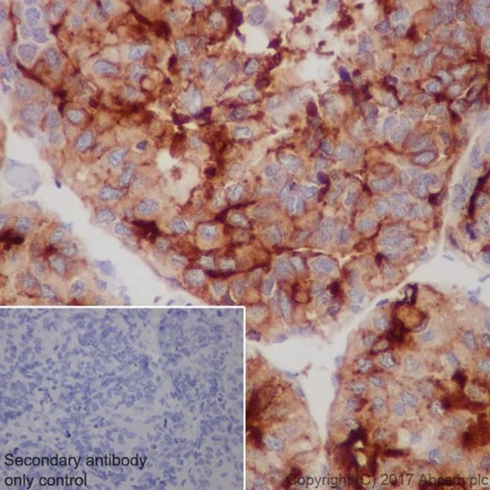 Immunohistochemistry (Formalin/PFA-fixed paraffin-embedded sections) - Anti-Glypican 3 antibody [EPR20569] (AB207080)