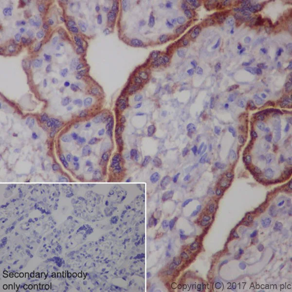 Immunohistochemistry (Formalin/PFA-fixed paraffin-embedded sections) - Anti-Glypican 3 antibody [EPR20569] (AB207080)