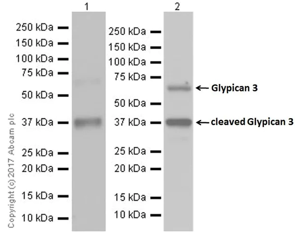 Western blot - Anti-Glypican 3 antibody [EPR20569] (AB207080)