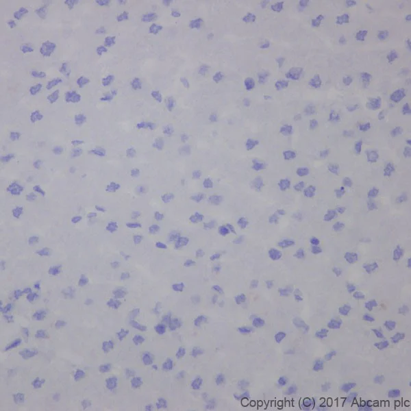 Immunohistochemistry (Formalin/PFA-fixed paraffin-embedded sections) - Anti-Glypican 3 antibody [EPR20569] - BSA and Azide free (AB240995)