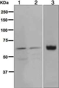 Western blot - Anti-Glypican 3 antibody [EPR5547] (AB124829)