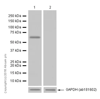 Western blot - Anti-Glypican 3 antibody [EPR5547] (AB124829)