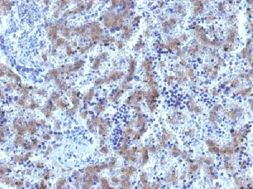 Immunohistochemistry (Formalin/PFA-fixed paraffin-embedded sections) - Anti-Glypican 3 antibody [GPC3/1534R] - BSA and Azide free (AB218874)