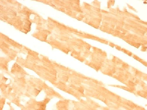 Immunohistochemistry (Formalin/PFA-fixed paraffin-embedded sections) - Anti-Glypican 3 antibody [GPC3/863] - BSA and Azide free (AB212411)