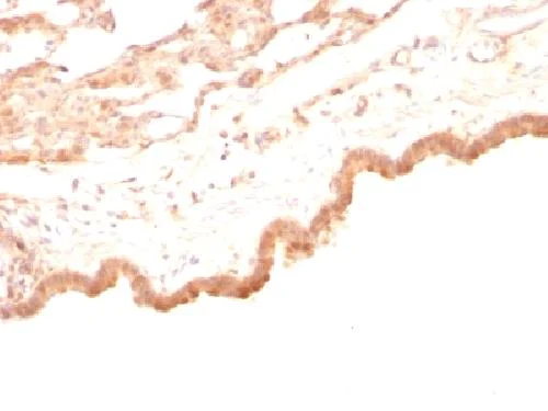 Immunohistochemistry (Formalin/PFA-fixed paraffin-embedded sections) - Anti-Glypican 3 antibody [GPC3/863] - BSA and Azide free (AB212411)