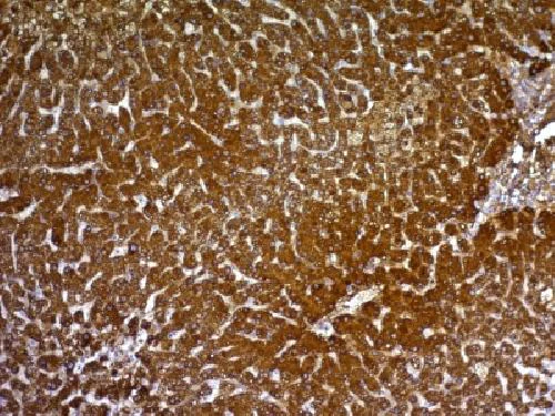Immunohistochemistry (Formalin/PFA-fixed paraffin-embedded sections) - Anti-Glypican 3 antibody [GPC3/863] - BSA and Azide free (AB212411)
