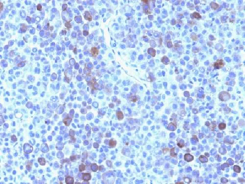Immunohistochemistry (Formalin/PFA-fixed paraffin-embedded sections) - Anti-Glypican 3 antibody [GPC3/863] - BSA and Azide free (AB212411)