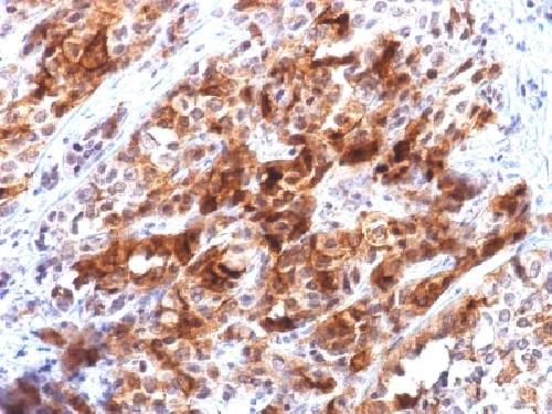 Immunohistochemistry (Formalin/PFA-fixed paraffin-embedded sections) - Anti-Glypican 3 antibody [rGPC3/863] (AB219313)