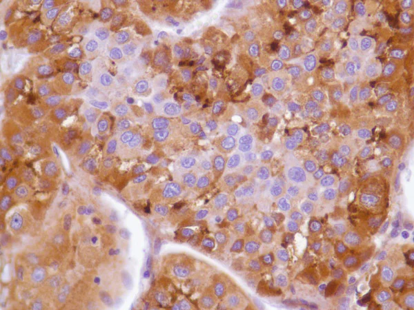 Immunohistochemistry (Formalin/PFA-fixed paraffin-embedded sections) - Anti-Glypican 3 antibody [SP86] - BSA and Azide free (AB238804)