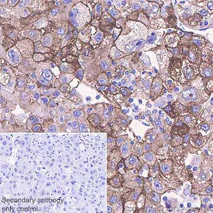 Immunohistochemistry (Formalin/PFA-fixed paraffin-embedded sections) - Anti-Glypican 3 antibody [SP86] - BSA and Azide free (AB238804)