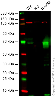 Western blot - Anti-Glypican 3 antibody [SP86] - BSA and Azide free (AB238804)