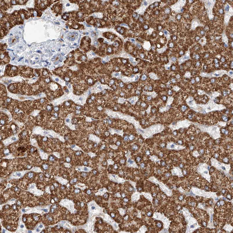 Immunohistochemistry (Formalin/PFA-fixed paraffin-embedded sections) - Anti-Glypican 4 antibody (AB246973)