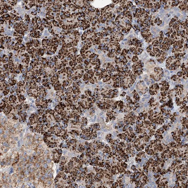 Immunohistochemistry (Formalin/PFA-fixed paraffin-embedded sections) - Anti-Glypican 4 antibody (AB246973)