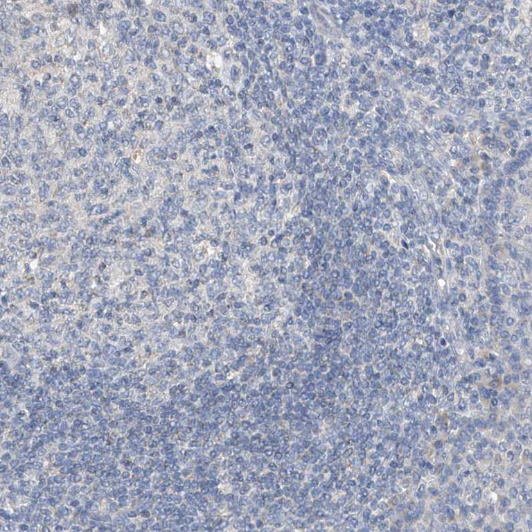 Immunohistochemistry (Formalin/PFA-fixed paraffin-embedded sections) - Anti-Glypican 4 antibody (AB246973)