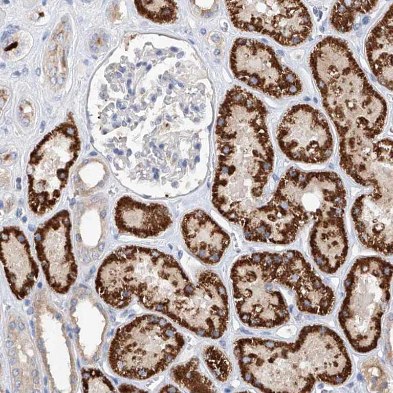 Immunohistochemistry (Formalin/PFA-fixed paraffin-embedded sections) - Anti-Glypican 4 antibody (AB246973)