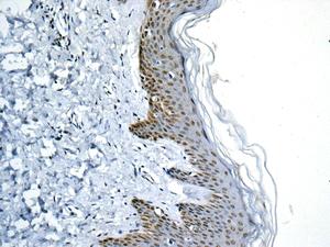 Immunohistochemistry (Formalin/PFA-fixed paraffin-embedded sections) - Anti-GLYR1 antibody [EPR10076(B)] (AB154838), expandable thumbnail
