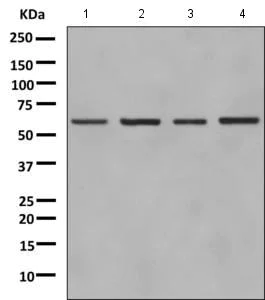 Western blot - Anti-GLYR1 antibody [EPR10076(B)] - BSA and Azide free (AB249142)