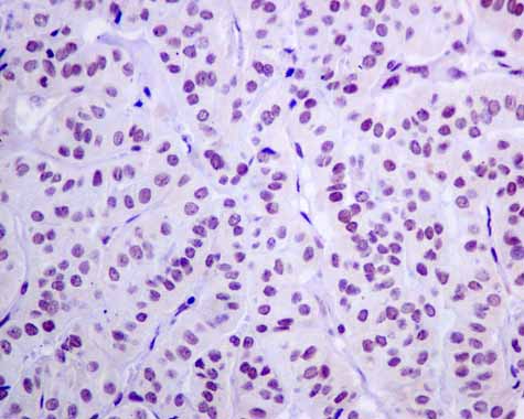 Immunohistochemistry (Formalin/PFA-fixed paraffin-embedded sections) - Anti-GLYR1 antibody [EPR10077(B)] (AB167155), expandable thumbnail