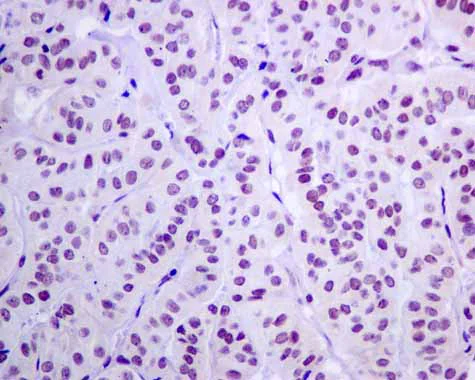 Immunohistochemistry (Formalin/PFA-fixed paraffin-embedded sections) - Anti-GLYR1 antibody [EPR10077(B)] (AB167155)