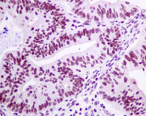 Immunohistochemistry (Formalin/PFA-fixed paraffin-embedded sections) - Anti-GLYR1 antibody [EPR10077(B)] (AB167155), expandable thumbnail