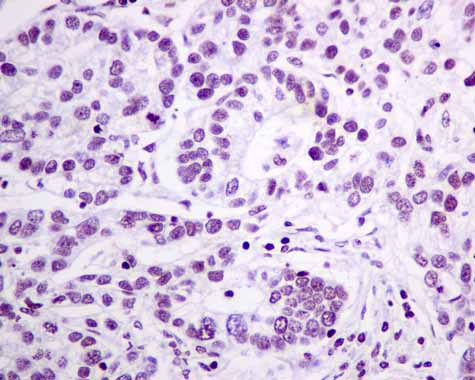 Immunohistochemistry (Formalin/PFA-fixed paraffin-embedded sections) - Anti-GLYR1 antibody [EPR10077(B)] (AB167155), expandable thumbnail