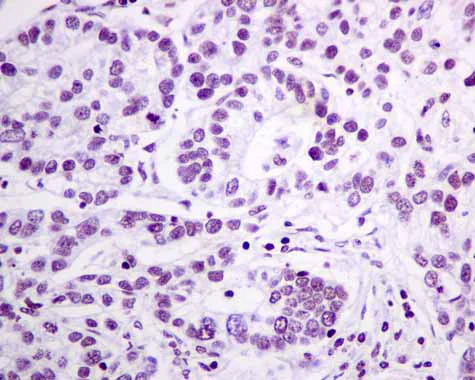 Immunohistochemistry (Formalin/PFA-fixed paraffin-embedded sections) - Anti-GLYR1 antibody [EPR10077(B)] (AB167155)