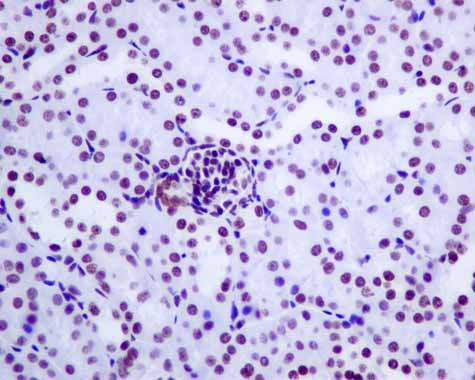 Immunohistochemistry (Formalin/PFA-fixed paraffin-embedded sections) - Anti-GLYR1 antibody [EPR10077(B)] (AB167155), expandable thumbnail