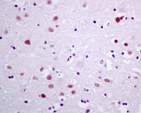 Immunohistochemistry (Formalin/PFA-fixed paraffin-embedded sections) - Anti-GLYR1 antibody [EPR10077(B)] (ab167155), expandable thumbnail