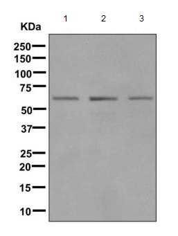 Western blot - Anti-GLYR1 antibody [EPR10077(B)] (ab167155), expandable thumbnail