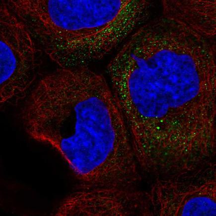Immunocytochemistry/ Immunofluorescence - Anti-GM-CSF antibody (AB220888)