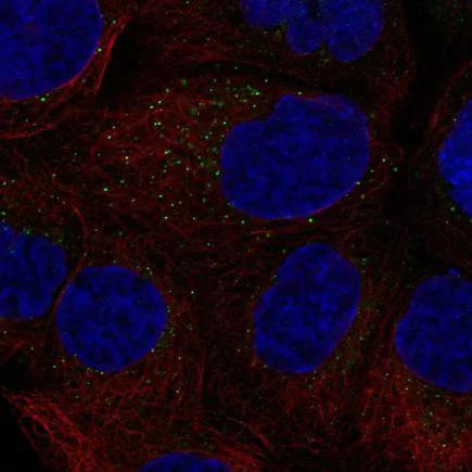Immunocytochemistry/ Immunofluorescence - Anti-GM-CSF antibody (AB221170)