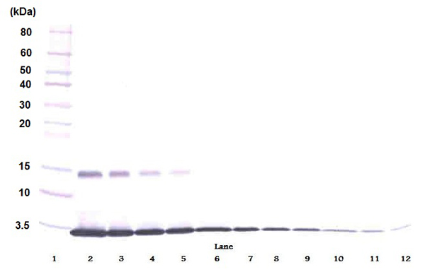 Western blot - Anti-GM-CSF antibody (AB9741), expandable thumbnail