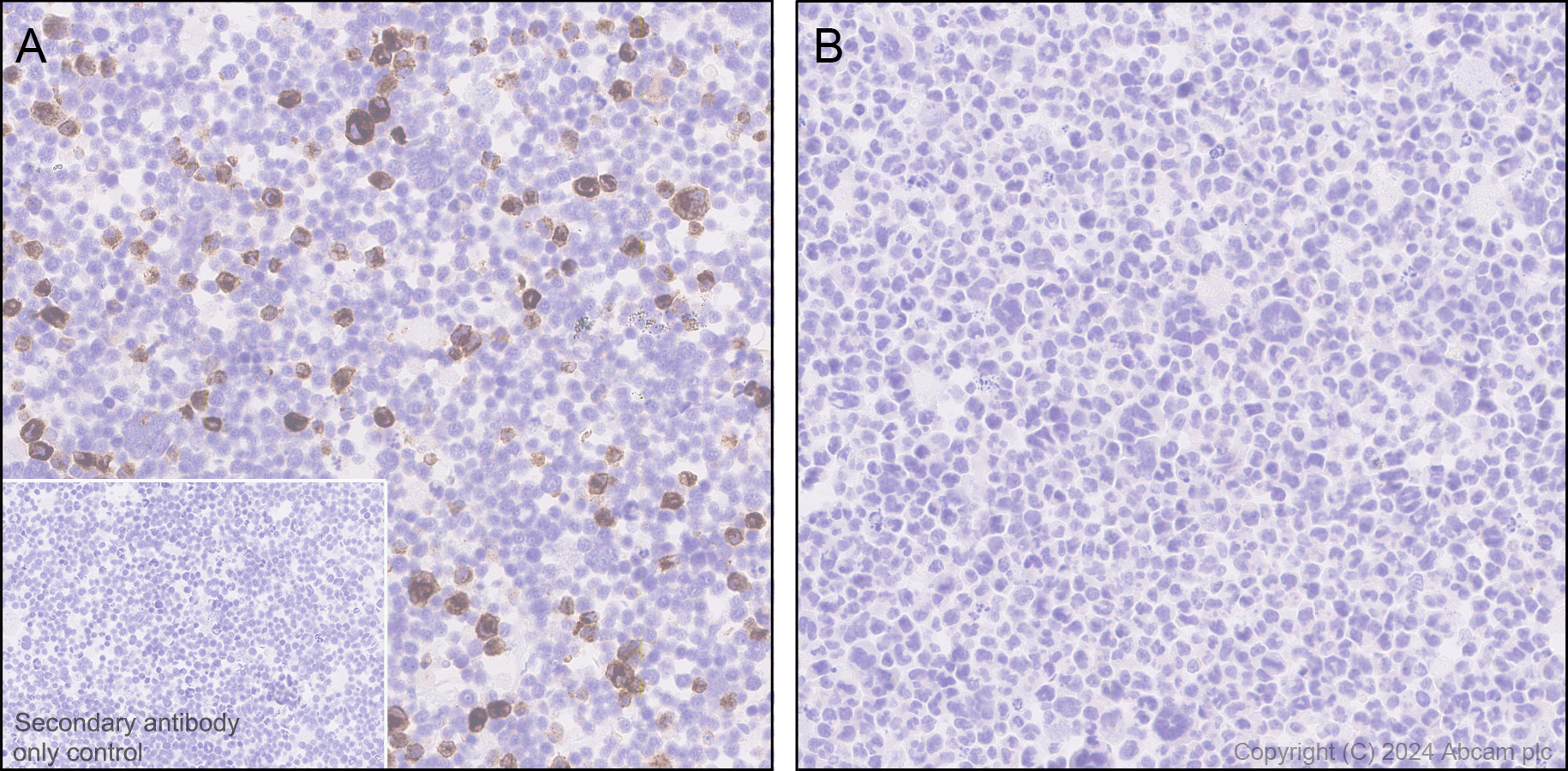 Immunohistochemistry (Formalin/PFA-fixed paraffin-embedded sections) - Anti-GM-CSF antibody [EPR28743-78] - BSA and Azide free (ab316863), expandable thumbnail