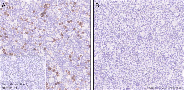 Immunohistochemistry (Formalin/PFA-fixed paraffin-embedded sections) - Anti-GM-CSF antibody [EPR28743-78] - BSA and Azide free (AB316863)