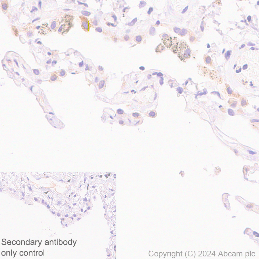 Immunohistochemistry (Formalin/PFA-fixed paraffin-embedded sections) - Anti-GM-CSF antibody [EPR28743-78] - BSA and Azide free (ab316863), expandable thumbnail