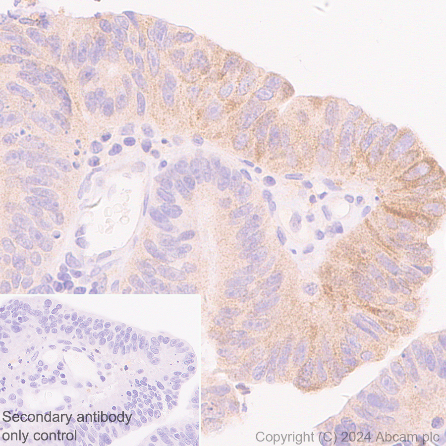 Immunohistochemistry (Formalin/PFA-fixed paraffin-embedded sections) - Anti-GM-CSF antibody [EPR28743-78] - BSA and Azide free (AB316863), expandable thumbnail