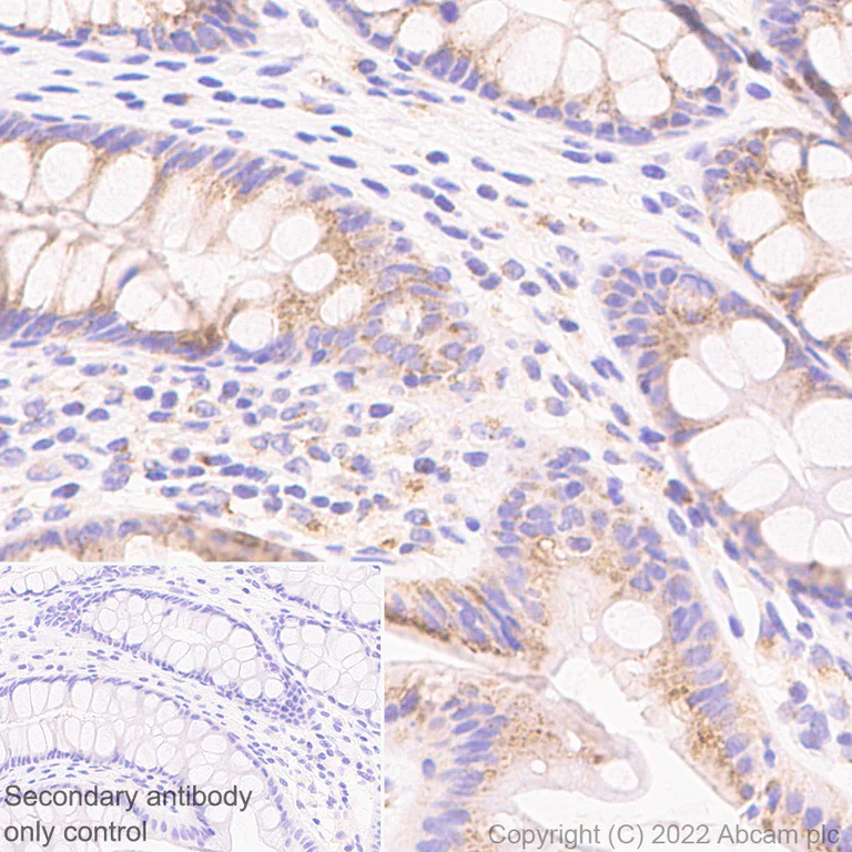 Immunohistochemistry (Formalin/PFA-fixed paraffin-embedded sections) - Anti-GM130 antibody [EP892Y] - Chicken IgY (Chimeric) (AB302489)