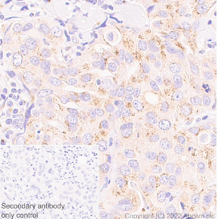 Immunohistochemistry (Formalin/PFA-fixed paraffin-embedded sections) - Anti-GM130 antibody [EP892Y] - Chicken IgY (Chimeric) - BSA and Azide free (AB302490)