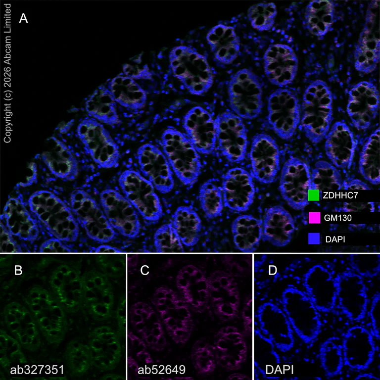 Multiplex immunohistochemistry - Anti-GM130 antibody [EP892Y] - cis-Golgi Marker (AB52649)
