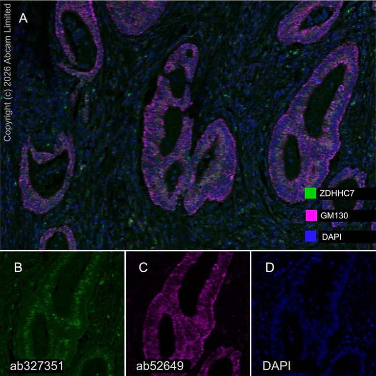 Multiplex immunohistochemistry - Anti-GM130 antibody [EP892Y] - cis-Golgi Marker (AB52649)