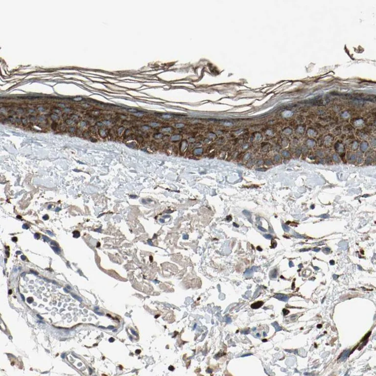 Immunohistochemistry (Formalin/PFA-fixed paraffin-embedded sections) - Anti-GM2A antibody (AB224246)