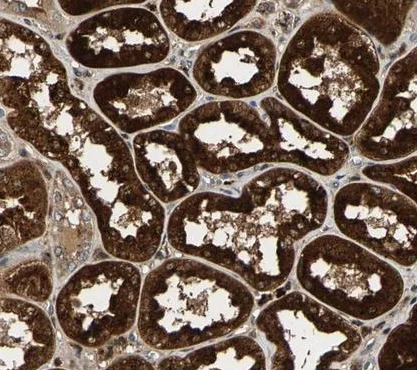 Immunohistochemistry (Formalin/PFA-fixed paraffin-embedded sections) - Anti-GM2A antibody (AB224246)